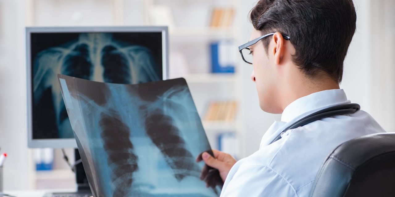 17.02.2021 Нижегородская область. Информация для пациентов с раком легкого иои с подозрением на рак легкого в Нижегородской области