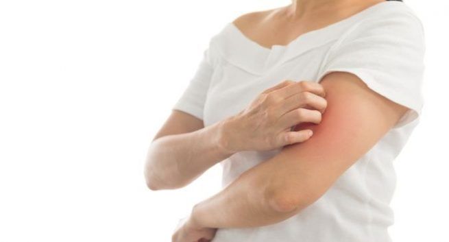 03.04.2019 Уфа. Академия псориаза «Чистая кожа»