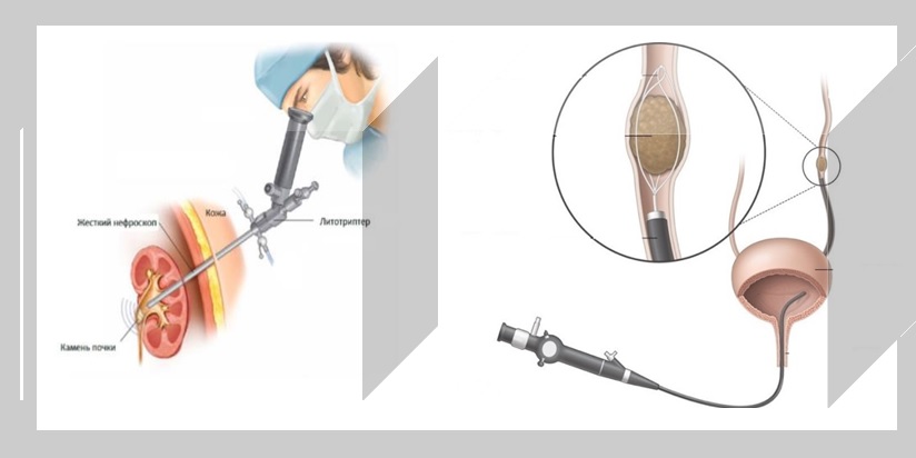 14.09.2022 Центр хирургии имени А.В. Вишневского приглашает на Школу пациентов (29 сентября)