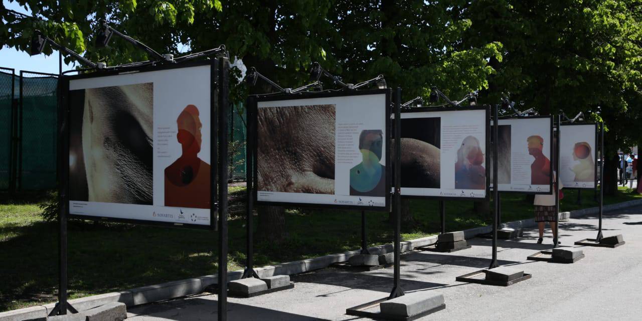 24.05.2019 В Казани открылась фотовыставка «Кожа: лунный пейзаж»